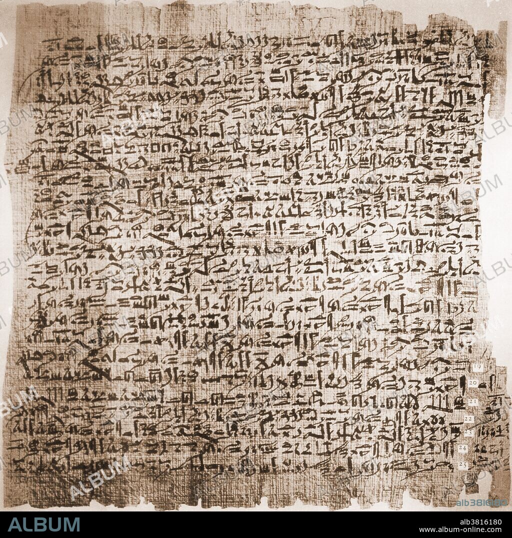 "Case Six from the Edwin Smith Surgical Papyrus, circa 1600 B.C. This document is written in hieratic, a cursive version of simplified hierogylphs. The case describes a gaping wound in the head with compound committed fracture of the skull and rupture of the meningeal membranes. This case is the first mention of the brain and its envelope in any medical document. The unknown surgeon describes the wound as 'an ailment not to be treated.' Edwin Smith purchased the papyrus in Thebes in 1862." It remained at the New York Historical Society until James Breasted of the Oriental Institute of Chicago deciphered and translated it as a series of clinical presentations in the1920s. (Quoted caption text from "The Edwin Smith Surgical Papyrus," by J. Breasted, University of Chicago, 1930.).