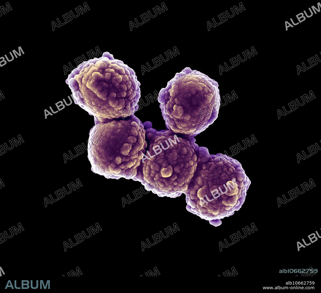 Scanning electron micrograph (SEM) of Micrococcus luteus, a Gram-positive to Gram-variable, nonmotile, Coccus, saprotrophic bacterium that belongs to the family Micrococcaceae. It is urease- and catalase-positive. An obligate aerobe, M. luteus is found in soil, dust, water and air, and as part of the normal flora of the mammalian skin. The bacterium also colonizes the human mouth, mucosae, oropharynx and upper respiratory tract. It was discovered by Sir Alexander Fleming before he discovered Penicillin in 1928. M. luteus forms bright yellow colonies on nutrient agar. It was sequenced in 2010 and has one of the smallest genomes of free-living actinobacteria sequenced to date.