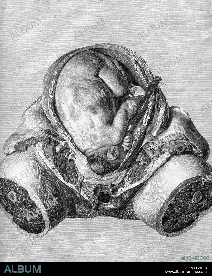 Table 6. William Hunter published numerous articles on anatomy, surgery and midwifery, but his most famous work was the beautiful Anatomia uteri humani gravidi, or The anatomy of the human gravid uterus. In his preface, Hunter states that many of the drawings were first prepared in 1751. A majority of the drawings were executed by Jan van Rymsdyk, and a great number of engravers participated in the project. Printed at Birmingham: by John Baskerville, 1774. William Hunter (May 23, 1718 - March 30, 1783) was a Scottish anatomist and physician. Hunter was trained in anatomy at St George's Hospital, London, specializing in obstetrics. His courtly manners and sensible judgement helped him to advance until he became the leading obstetric consultant of London. To orthopedic surgeons he is famous for his studies on bone and cartilage. In 1768 he built the famous anatomy theatre and museum in Soho, where the best British anatomists and surgeons of the period were trained. He died in 1783, at the age of 64.