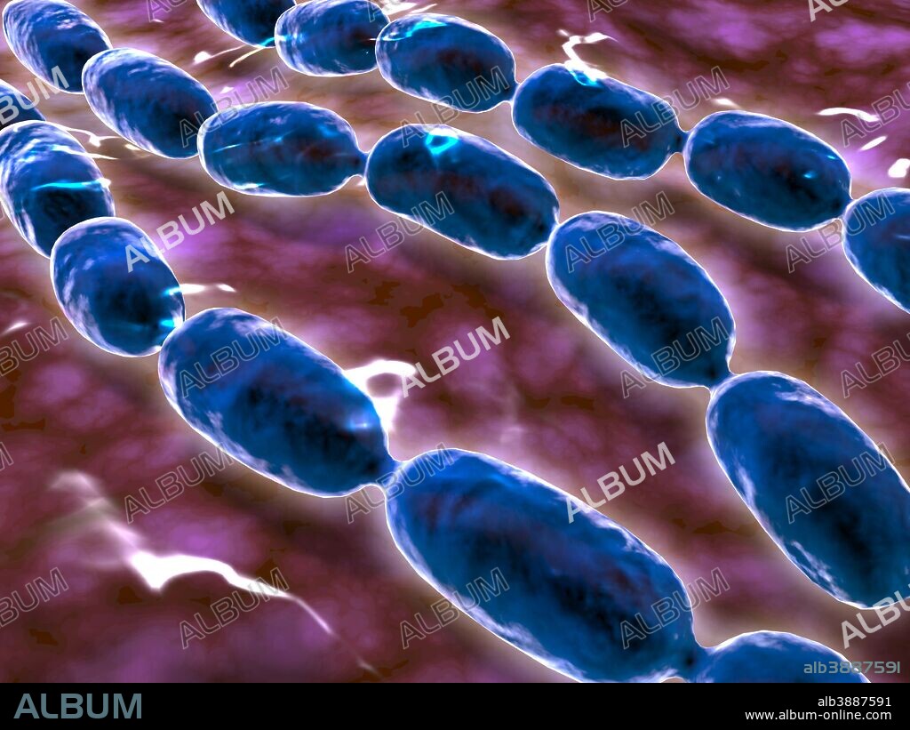 Microscopic view of bacterial pneumonia. Bacterial pneumonia is a type of pneumonia caused by bacterial infection. Pneumonia can be generally defined as inflammation of the lung parenchyma.