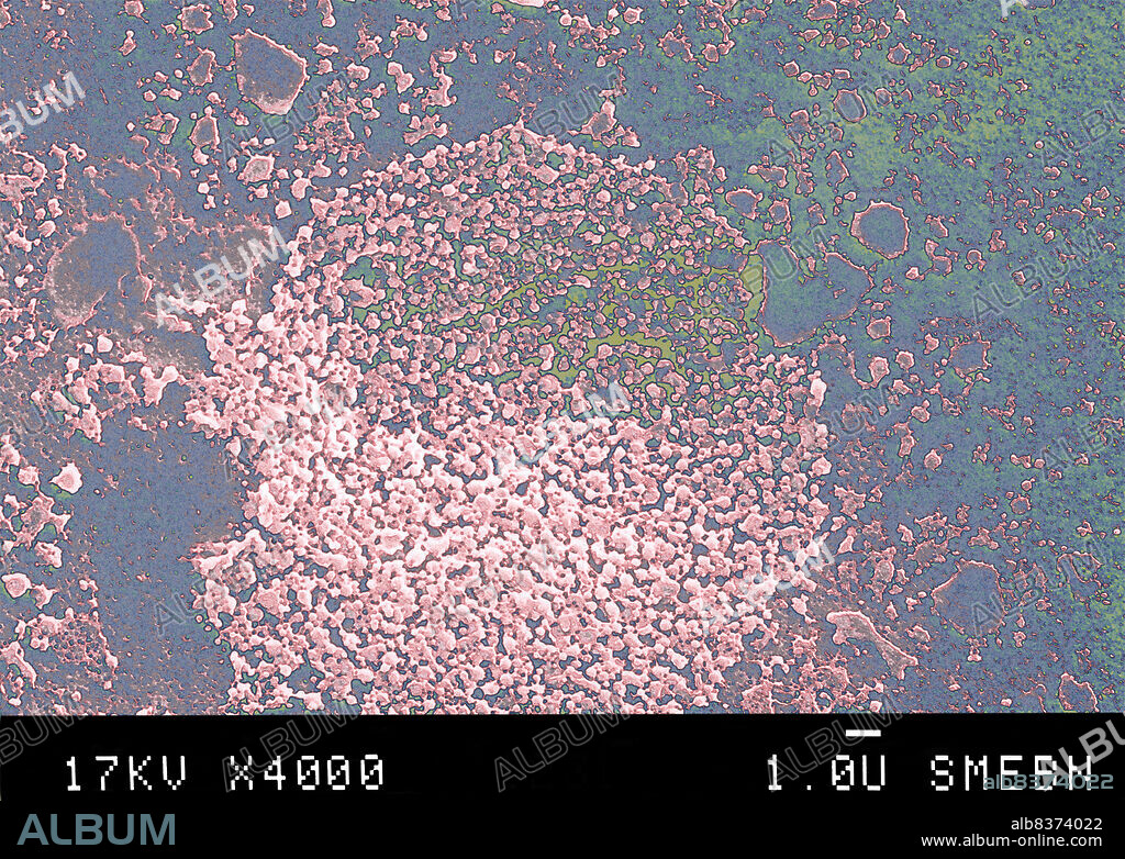 Mycoplasmas are miniscule bacteria lacking a cell wall. Found in nature, in humans, and in animals, mycoplasmas are the smallest known organisms capable of growth and reproduction outside living host cells. Mycoplasma hominis causes gyneco-obstetric problems (urethritis, salpingitis, pregnancy complications). Tetracyclines (antibiotics) are effective, but should be used to treat partners since mycoplasmas are sexually transmissible. SEM 4000x.