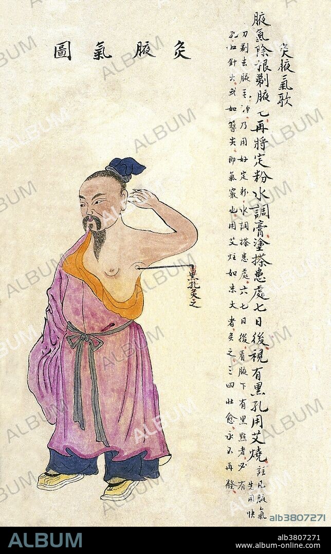 Chinese Acu-moxa Point Chart, 1869