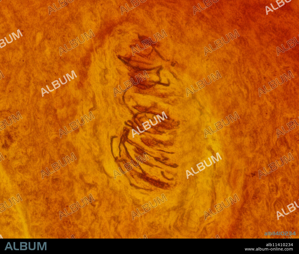 Meissner corpuscles located in the dermal papillae of the glabrous skin of the finger pads. The spiral path of the nerve fiber within the corpuscle is typical of these structures. Silver impregnation.