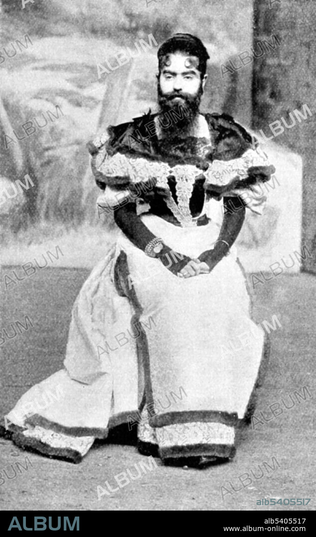 Annie Jones Elliot (July 14, 1865 - October 22, 1902) was an American bearded woman. Whether the cause of her condition was hirsutism or an unrelated genetic condition that affects children of both sexes and continues into adult years is unknown. When Jones joined Barnum's exhibition as a child of only nine months, her parents received a $150/week salary.  By the age of five, she had a mustache and sideburns and became well known as the 'Bearded Girl.' As an adult, she became the country's top 'bearded lady' and acted as a spokesperson for Barnum's 'Freaks', a word she tried to abolish from the business. She died In 1902, at the age of 37, of tuberculosis. The Wonder Book of Freaks and Animals in the Barnum & Bailey Greatest Show on Earth, 1898.