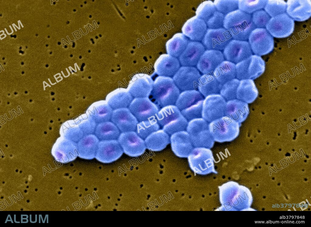 Scanning Electron Micrograph (SEM) of Acinetobacter baumannii. This aerobic gram-negative, non-motile bacteria are normal flora on the skin. But because A. baumannii has developed substantial antimicrobial resistance, it is an emerging cause of nosocomial infections in hospitals, responsible for pneumoniae, hemopathic and wound infections. Magnification of 13331x.