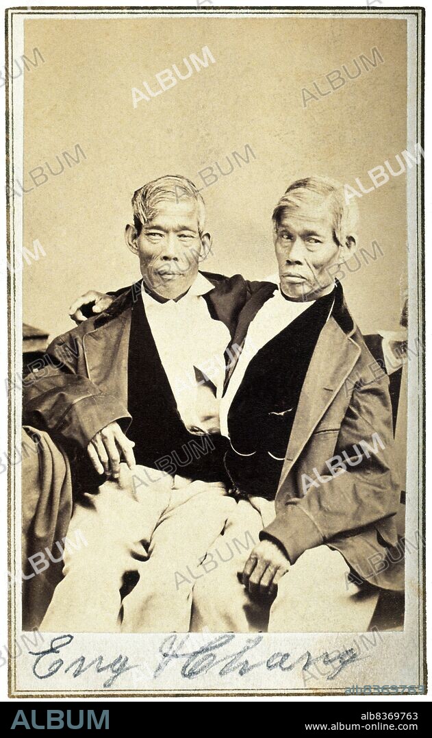 Chang and Eng Bunker (May 11, 1811 January 17, 1874) were Thai-American conjoined twin brothers whose condition and birthplace became the basis for the term 'Siamese twins'.<br/><br/>. The Bunker brothers were born on May 11, 1811, in the province of Samutsongkram, near Bangkok, in the Kingdom of Siam (today's Thailand). Their fisherman father was a Chinese Thai, while their mother was a Chinese Malaysian. Because of their Chinese heritage, they were known locally as the 'Chinese Twins'. The brothers were joined at the sternum by a small piece of cartilage, and though their livers were fused, they were independently complete.<br/><br/>. In 1829, Robert Hunter, a Scottish merchant who lived in Bangkok, saw the twins swimming and realized their potential. He paid their parents to permit him to exhibit their sons as a curiosity on a world tour. When their contract with Hunter was over, Chang and Eng went into business for themselves. In 1839, while visiting Wilkesboro, North Carolina, the brothers were attracted to the area and purchased a 110-acre (0.45 km2) farm in nearby Traphill.<br/><br/>. Determined to live as normal a life they could, Chang and Eng settled on their small plantation and bought slaves to do the work they could not do themselves. Using their adopted name 'Bunker', they married local women on April 13, 1843. Chang wed Adelaide Yates, while Eng married her sister, Sarah Anne. Chang and Adelaide would become the parents of eleven children. Eng and Sarah had ten. The twins also became naturalized American citizens.<br/><br/>. On January 17, 1874, Chang died while the brothers were asleep. Eng awoke to find his brother dead and cried, 'Then I am going'. A doctor was summoned to perform an emergency separation, but he was too late. Eng died approximately three hours later.