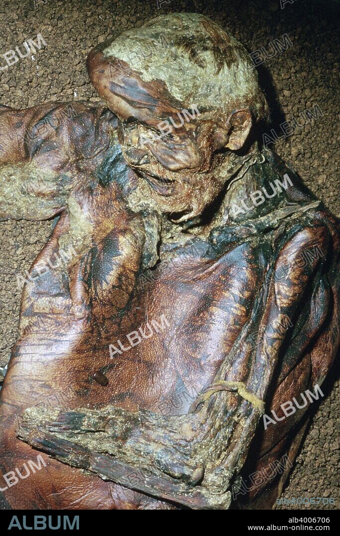 A Celtic iron age man, approximately twenty, found in 1984 in Lindow Moss peat bog, Cheshire. It is likely that he was ritually killed before being deposited in the bog, c2nd century BC.