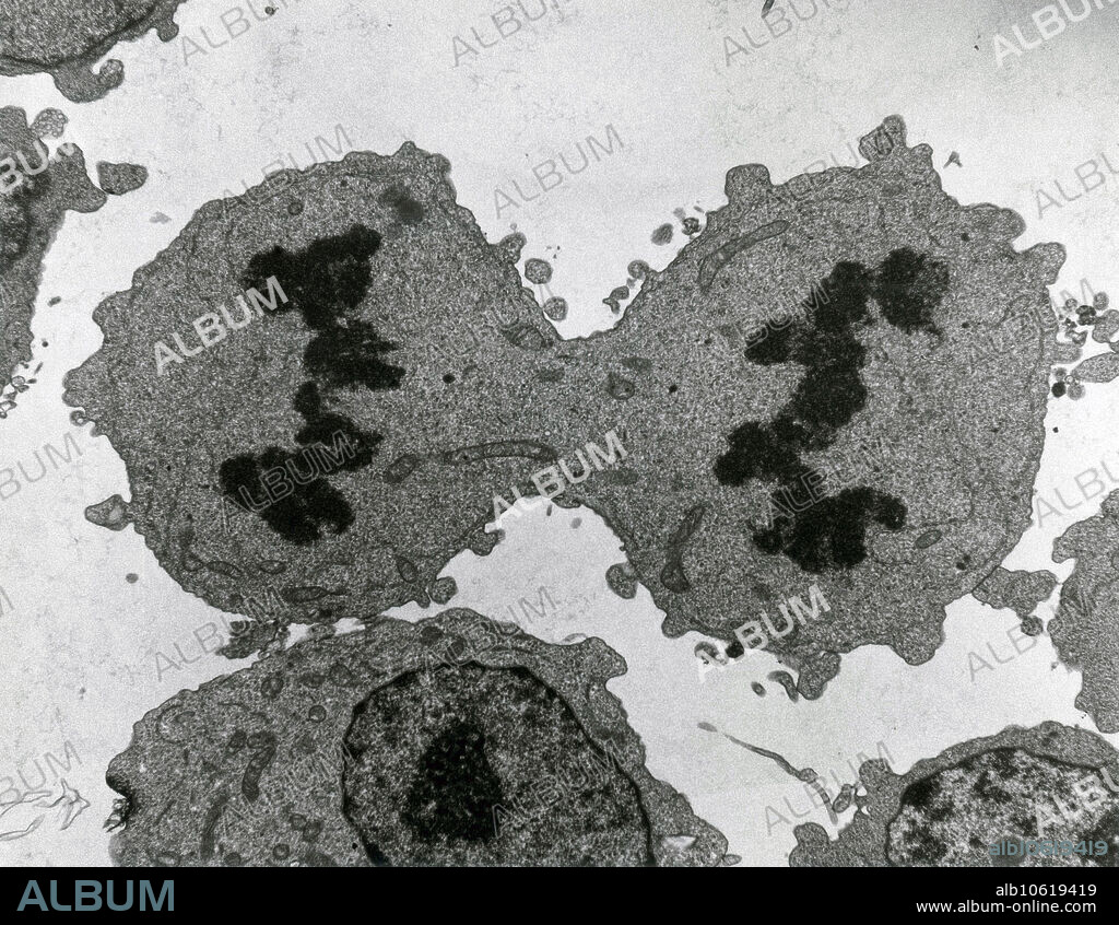 Transmission electron micrograph showing mitosis, telophase. No magnification given. Mitosis, the usual method of cell division, characterized typically by the resolving of the chromatin of the nucleus into a threadlike form, which condenses into chromosomes, each of which separates longitudinally into two parts, one part of each chromosome being retained in each of two new cells resulting from the original cell. The four main phases of mitosis are prophase, metaphase, anaphase, and telophase.