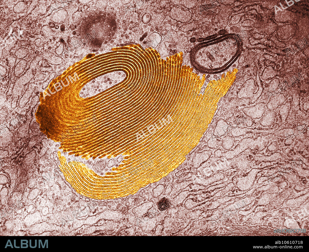 Colour enhanced electron micrograph of Golgi apparatus at 125,000x. This cell structure (similar to endoplasmic reticulum) processes lipids and proteins synthesized in the endoplasmic reticulum and stores and packs materials to be exported from the cell. It is often called the shipping department of the cell with vesicles that pinch off, moving to the cell membrane to release material from the cell.