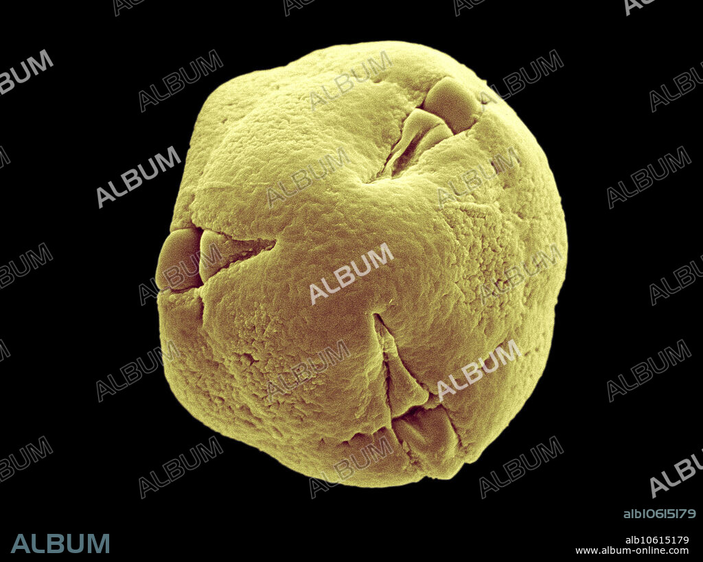 Colorized scanning electron micrograph of blueberry (Vaccinium corymbosum) pollen. The pollen is shed from pores in the anthers onto the bodies of bumblebees and solitary bees that vibrate the flowers. Honeybees do not sonicate blueberry flowers and rarely collect much blueberry pollen. Blueberries are native to the Eastern United States. Blueberries are related to huckleberries, rhododendrons, and azaleas. These plants also thrive in environments similar to the ideal blueberry environment, that is acidic soil. Image width: 71 micrometers. Magnification: 1408x if the image is printed 10 cm wide.