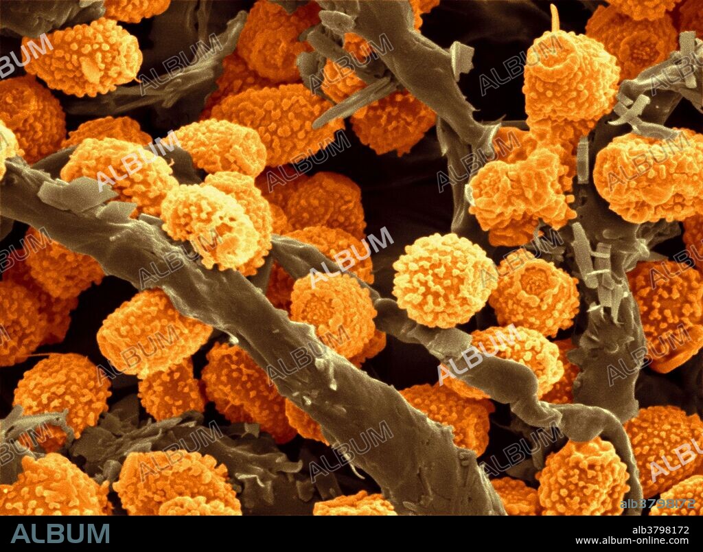 Scanning electron micrograph (SEM) of eurotium chevalieri fungal spores. The fungus grows on dehydrated foods with high sugar contents. The spores may cause allergies. Image width: 24.2 micrometers.