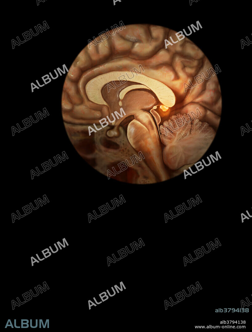 Three-dimensional visualisation based on segmented human data of the pineal gland (yellow), a small organ located on the posterior part of the roof of the third ventricle, seen here below the corpus collosum. It is connected to the brain via a short stalk containing nerve fibers which communicate with the hypothalamus. The pineal gland secretes the hormone melatonin which regulates the circadian rhythms of the body. Its secretion during hours of darkness produces a hypnotic effect which results in sleep.