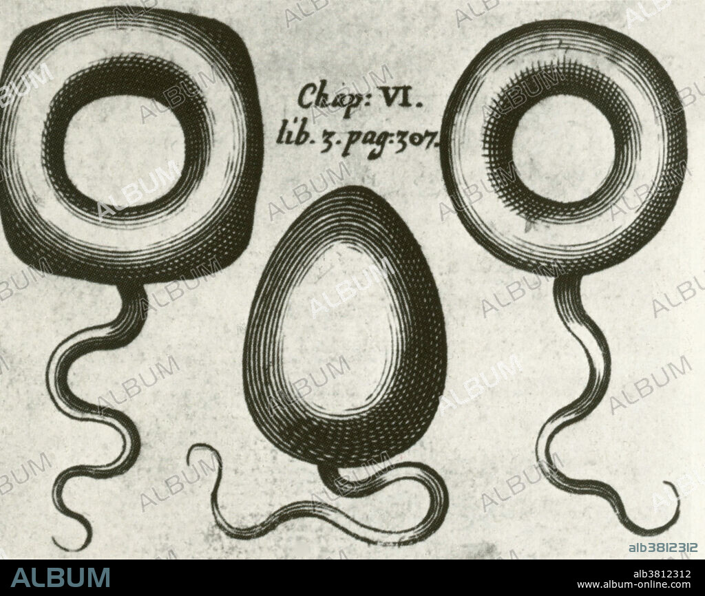 Pessaries, Medical Equipment, 17th C