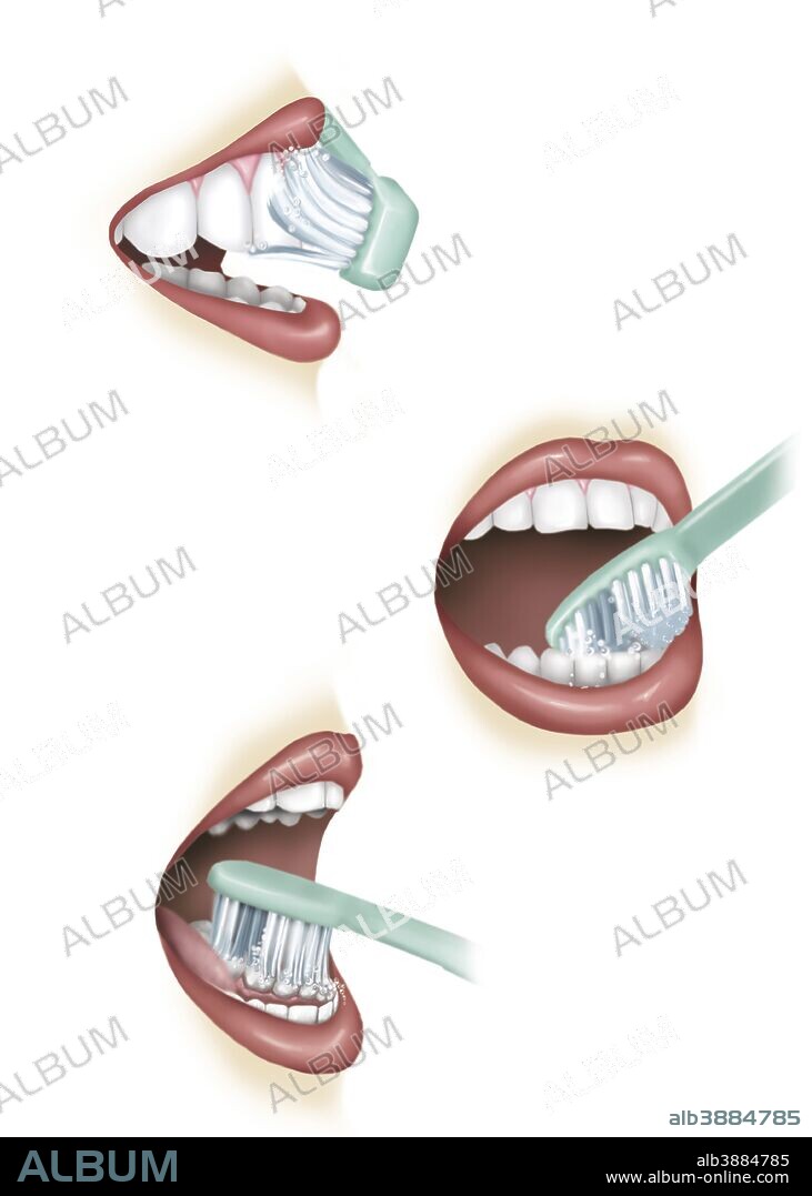 Proper clearance tooth brushing