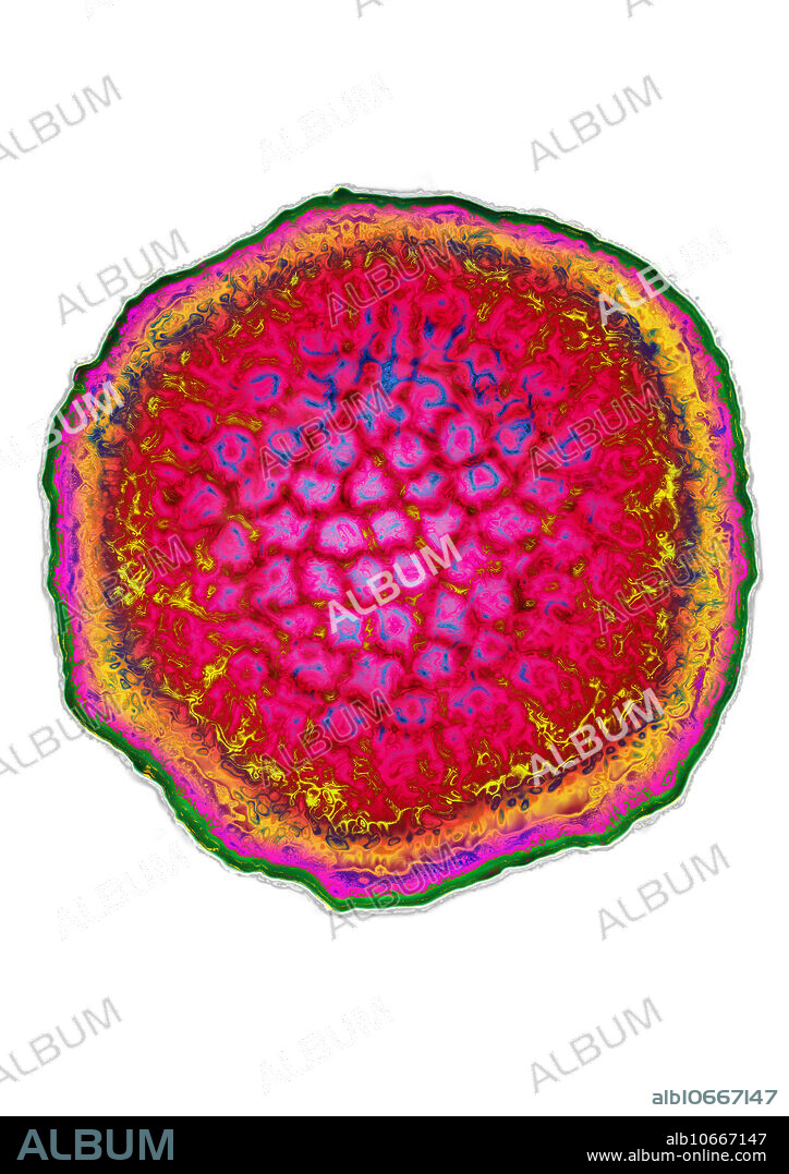 Herpes Simplex Virus (HSV4) is the Epstein-Barr Virus (EBV), responsible for infectious mononucleosis. Viral diameter approximately 200nm. Viral magnification 500,000x at 10cm and image colorization with HDRI treatments on a Transmission Electron Micrograph view (TEM).