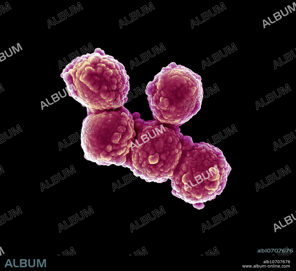 Scanning electron micrograph (SEM) of Micrococcus luteus, a Gram-positive to Gram-variable, nonmotile, Coccus, saprotrophic bacterium that belongs to the family Micrococcaceae. It is urease- and catalase-positive. An obligate aerobe, M. luteus is found in soil, dust, water and air, and as part of the normal flora of the mammalian skin. The bacterium also colonizes the human mouth, mucosae, oropharynx and upper respiratory tract. It was discovered by Sir Alexander Fleming before he discovered Penicillin in 1928. M. luteus forms bright yellow colonies on nutrient agar. It was sequenced in 2010 and has one of the smallest genomes of free-living actinobacteria sequenced to date.
