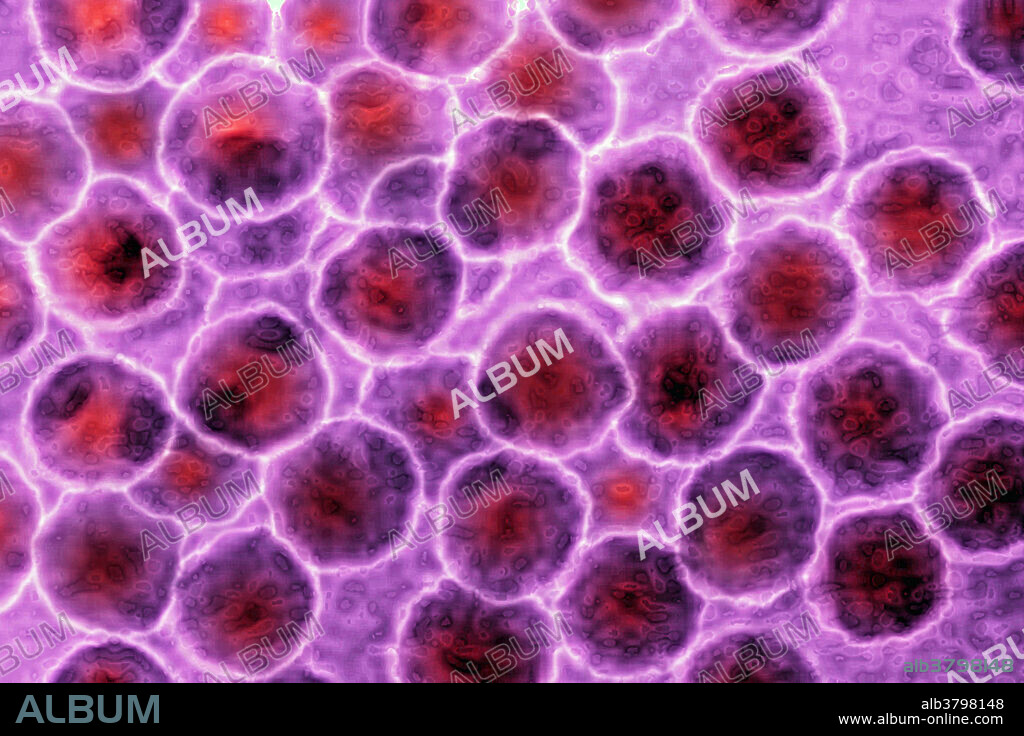 Color enhanced Transmission Electron Microscopy of picornavirus (Picornaviridae). They are a family of viruses that includes: enterovirus; rhinovirus; Hepatovirus A; poliovirus; coxsackie virus; echoviruses; Parechovirus. (viral diameter 20 to 30 nm).