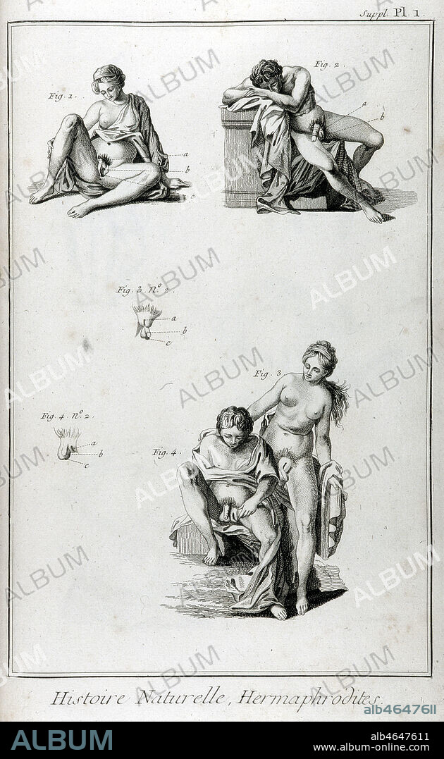 Homme et femme hermaphrodite. Gravure de L'Encyclopedie Diderot et d'Alembert vers 1760. Credit: Coll. BHVP-Grob/KHARBINE-TAPABOR.
