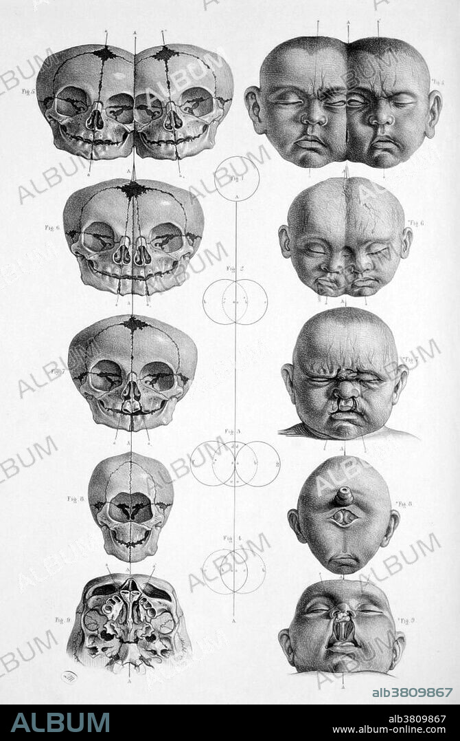 Surgical Anatomy, 1856
