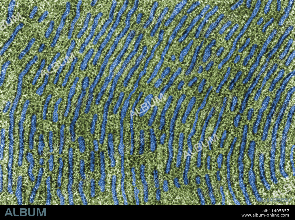 Color-enhanced transmission electron microscope (TEM) micrograph showing the cytoplasm of a protein-synthetizing cell packed with parallel cisterns of rough endoplasmic reticulum. The lumen of cisternae is labelled in blue color and the cytoplasm, full of ribosomes, is labelled in green color. x25,000.