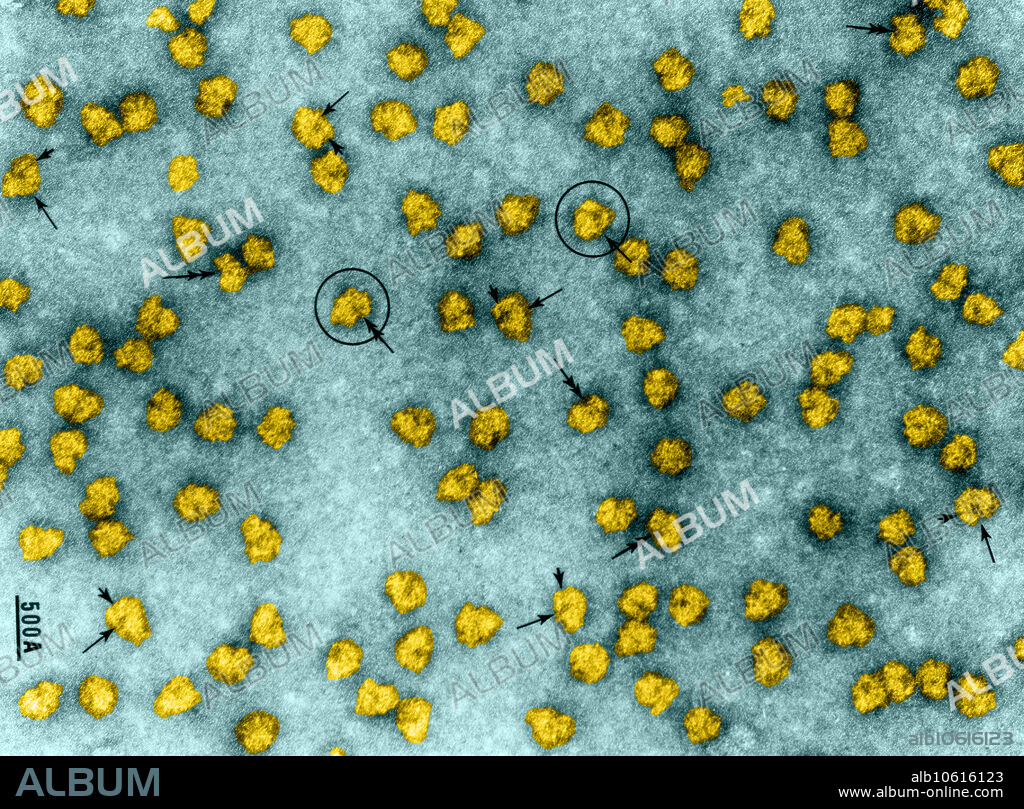 Color enhanced transmission electron microscope (TEM) of a field of monomeric ribosomes. The ribosome is a complex molecular machine, found within all living cells, that serves as the site of biological protein synthesis (translation). Amino acids are natural monomers that polymerize at ribosomes to form proteins. Shown here are several frontal (arrows) and lateral (double arrows) images. Most lateral images are of the "right" type and most frontal images are left-featured, but one is right-featured (marked by a circle). An image which is intermediate between a right-featured frontal and left lateral image is also seen (circle with double arrows). Small subunit partitions are indicated by short arrows. Note that in left-featured frontal images the dense line in between subunits is not prominent towards the right side of the dense spot which is under the small subunit partition. Magnification 225,000x @ 5x7 inches.