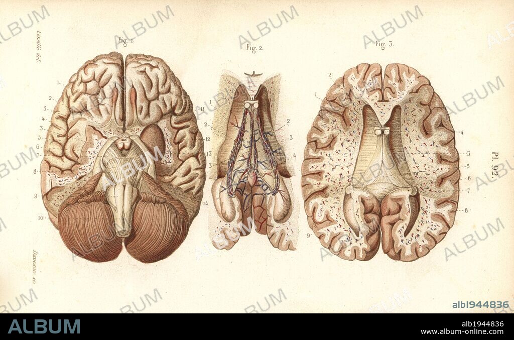 Sections through the brain and pineal gland. Handcolored steel engraving by Davesne of a drawing by Leveille from Dr. Joseph Nicolas Masse's "Petit Atlas complet d'Anatomie descriptive du Corps Humain," Paris, 1864, published by Mequignon-Marvis. Masse's "Pocket Anatomy of the Human Body" was first published in 1848 and went through many editions.