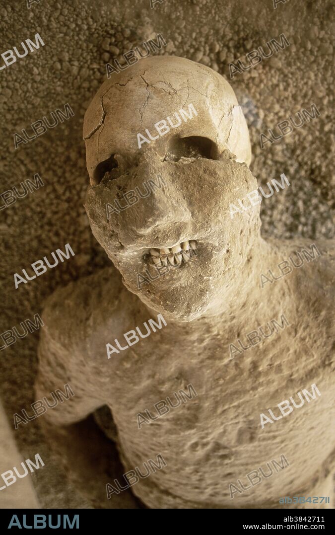 A plaster body cast of a victim of the 79 AD eruption of Mount Vesuvius, Pompeii, Italy. Close up of head and torso with part of skull and teeth exposed.