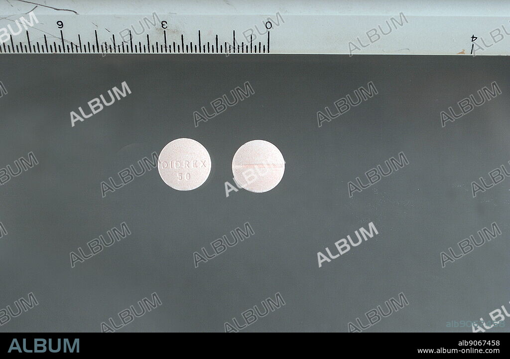 Benzphetamine (Didrex) 50 mg tablets. This is an anorectic drug marketed under this brand in the USA by Pharmacia. Benzphetamine is used as a short term adjunct in management of exogenous obesity. It is closely related to amphetamine. Benzphetamine is a sympathomimetic amine and is classified as an anorectic. The drug's main function is to reduce appetite, which in turn reduces caloric intake. Benzphetamine may cause vivid hallucinations when abused.