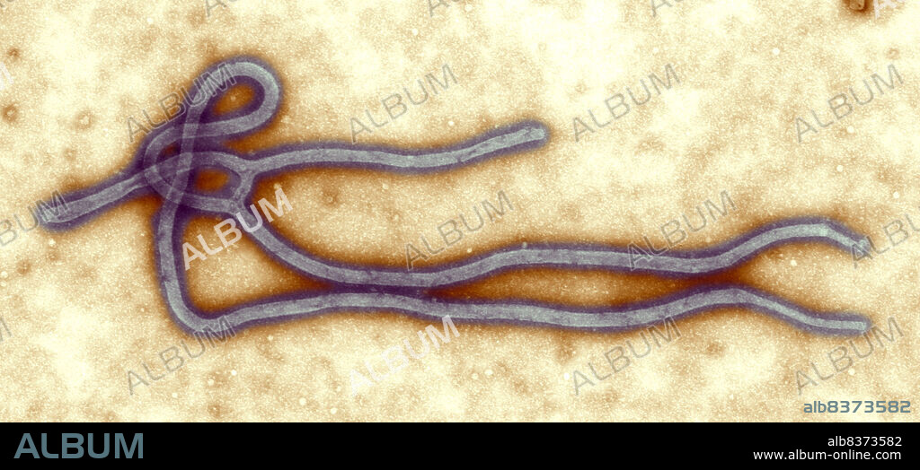 Transmission Electron Micrograph of the Ebola Virus (RNA virus), the cause of hemorrhagic fever.