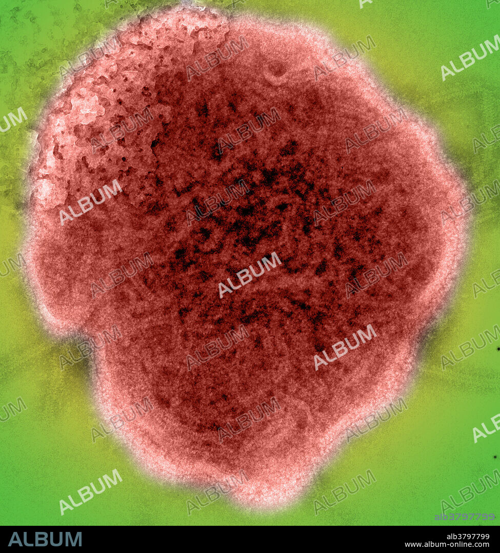 Transmission Electron Micrograph (TEM) of the mumps virus.