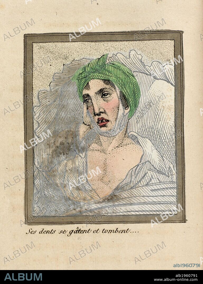 His teeth rot and fall out. . Le Livre Sans Titre (the book without title.). Paris, 1830. A book warning of the deadly perils of self abuse, or masturbation. The illustraions show the decline of a healthy and handsome young man under the influence of the vice. Source: 12316.eee.11. Language: French.
