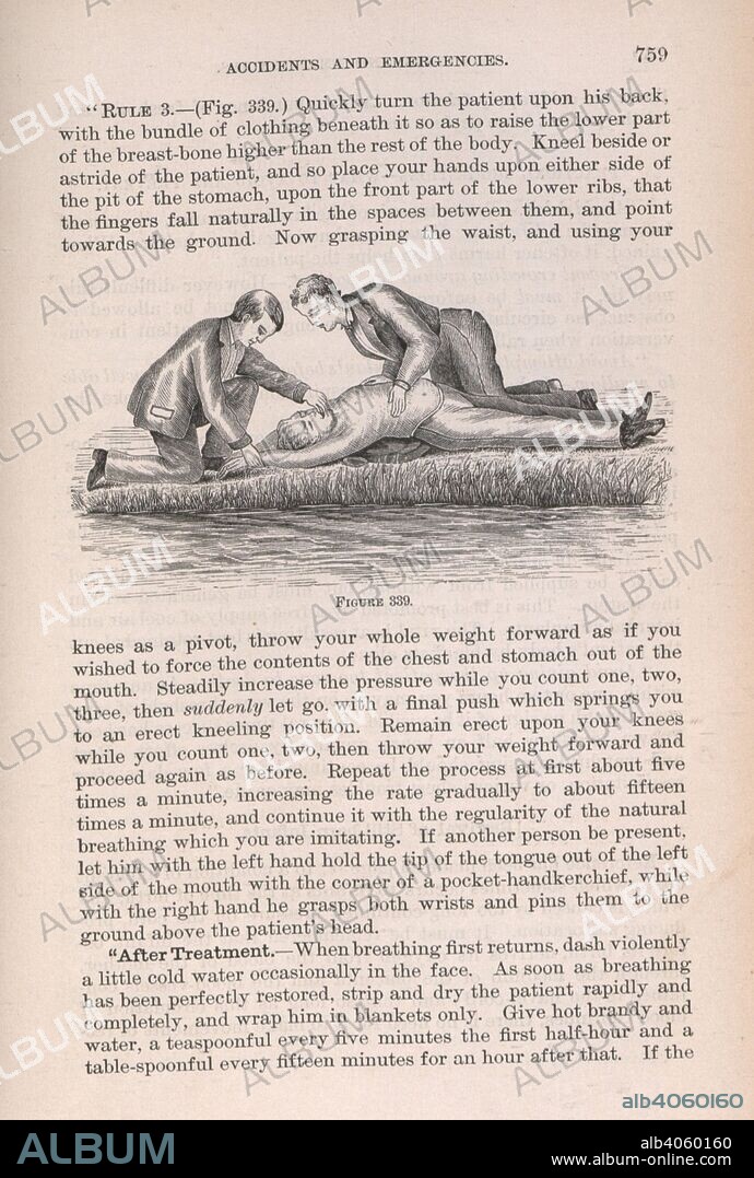 GEORGE BACON. WOOD. Two men giving first aid to another who has been saved from drowning. Wood's Household Practice of Medicine, Hygiene and Surgery. A practical treatise for the use of families, travellers ... and others. Edited by F. A. Castle ... Illustrated, etc. London [New York printed?] : Sampson Low & Co., 1881. Source: 7390.i.6. Language: English.