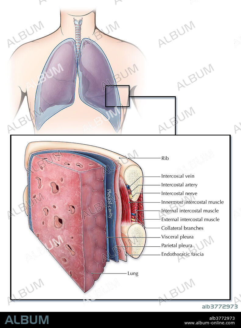 An illustrated section of a lung and the ribcage showcasing different layers of tissue and muscle. The pleura (blue) is a serous membrane covering the lungs (visceral pleura) and chest wall (parietal pleura), creating a fluid filled space (pleural cavity) which lubricates the lungs to aid in breathing. Between each rib are a series of intercostal muscles, arteries, veins and nerves. A layer of endothoracic fascia also lines the inner surface of the ribcage.