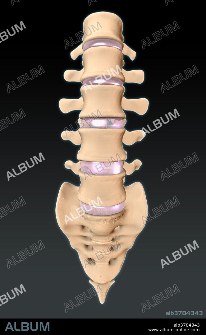 An illustration of the lower spine from an anterior view, showing the five lumbar vertebrae, the intervertebral discs (pink), and sacrum.