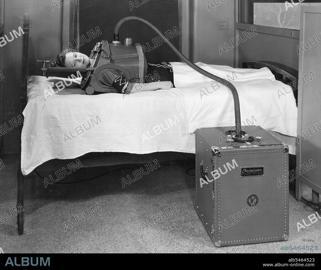 Portable iron lung designed by a Boston manufacturing firm for use in a hospital or in transporting polio-stricken patients, Boston, MA, 1949. (Photo by Russell B Harding/United States Information Agency/GG Vintage Images).