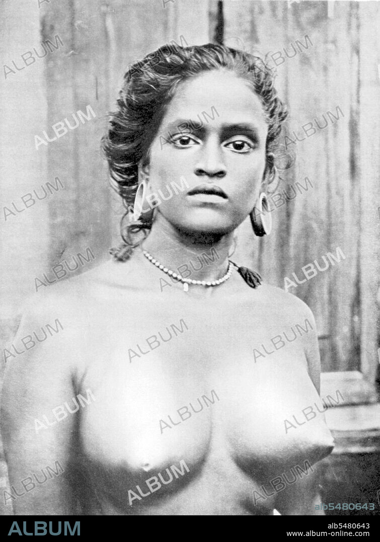 Woman of the Tiyan caste in Malabar, where the females of many castes wear no clothing above the waist. Metal discs or rolls of palm-leaf are inserted in the lobes of the ears, which are dilated during infancy. The tali (marriage badge) and metal talismans are suspended from a necklace round the neck.