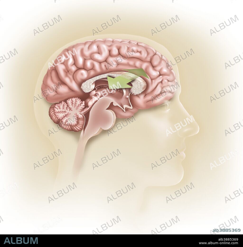 Sagittal view of human brain showing the corpus callosum.