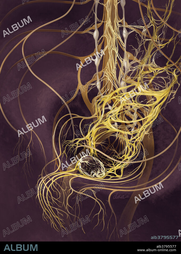 Illustration showing applied anatomy of nerves surrounding the prostate. Nerves shown include: Left and right pelvic (Inferior hypogastric) plexus, leading down to the left and right cavernous nerves, and these in turn give off the prostatic nerves. In the background of the image, the doral rami of the spinal nerves (including the cauda equina of the spinal cord) and sympathetic trunk with gray and white rami communicantes are shown. The dorsal nerve of the penis is shown along with the greater cavernous nerve of the penis, which originates in the prostatic plexus.