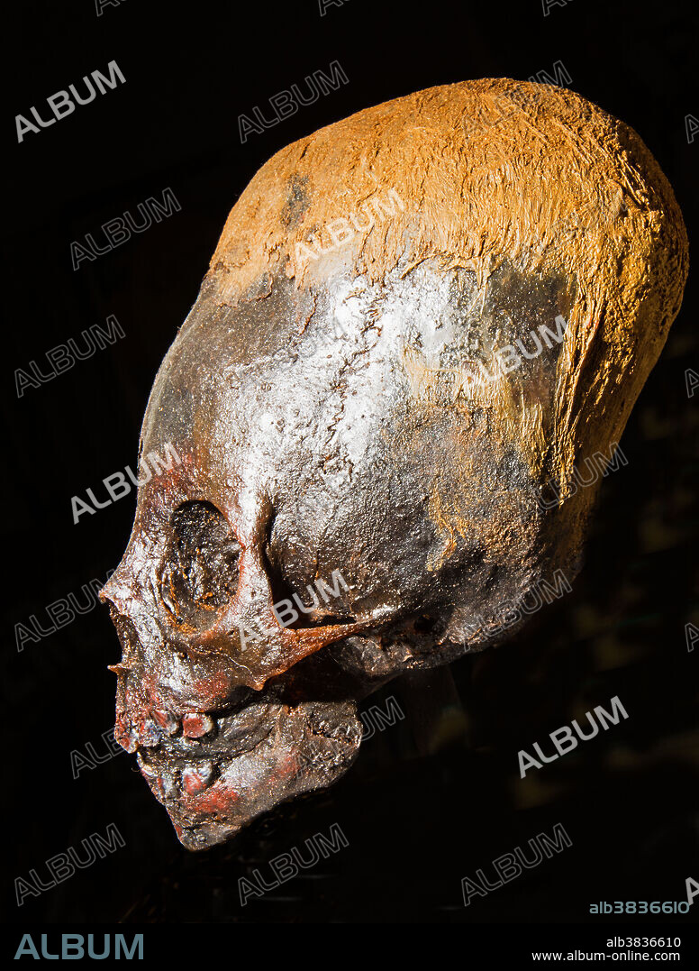 Elongated Skull. Paracas Culture. Paracas Chongos. Private Collection.
