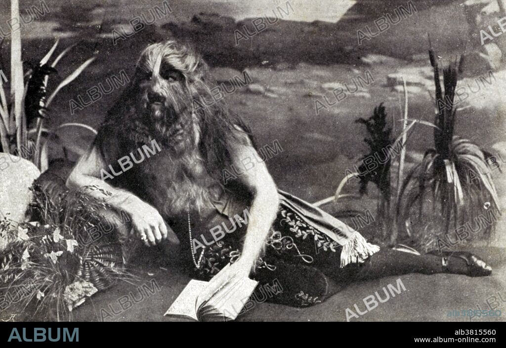 Stephan Bibrowski (1891-1932), better known as Lionel the Lion-faced Man, was a famous sideshow performer born with a rare condition called hypertrichosis. His mother blamed the condition on the mauling of his father by a lion, which she witnessed while pregnant with Stephan. She gave her son up to a German impresario named Sedlmayer when he was four. Sedlmayer gave him his stage name and started exhibiting him around Europe. His body was almost entirely covered with hair, the only exceptions being the palms of his hands and the soles of his feet. In 1901, Lionel traveled to the United States and started appearing with the Barnum and Bailey Circus. In his act, Lionel performed gymnastic tricks, and also spoke to people to show his gentle side that sharply contrasted with his appearance. He settled down permanently in the US in 1920, becoming a popular attraction, and moved to New York City, where he was a fixture at Coney Island. By the late 1920s, Lionel retired from his sideshow career and moved back to Germany. He was reported to have died in Berlin from a heart attack in 1932 at the age of 41. Dated 1918, no photographer credited.