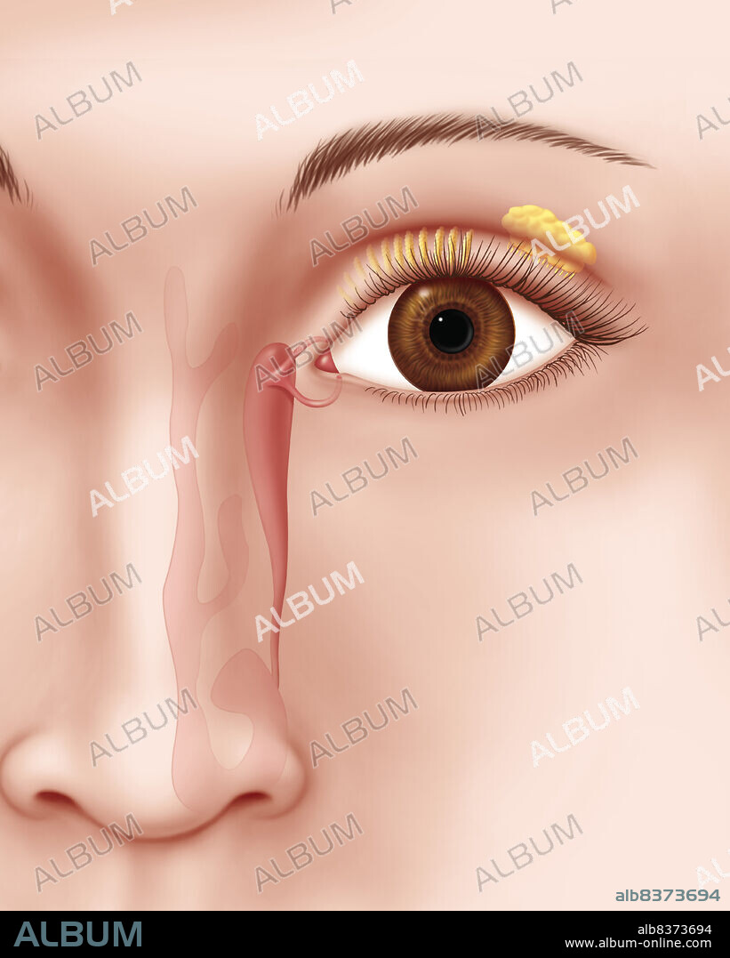 Lacrymal apparatus : lacrimal canal and lacrymal gland, Meibomian gland.. At the left of the eye we can find the lacrymal points continued by the lacrymal canals, one superior and, the other inferior, continued by the lacrymal sac, then the canal lacrymo-nasal until the nasal cavity.