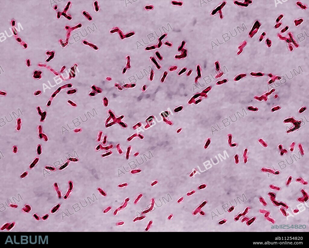Bordetella pertussis (bacillus of Bordet-Gengou or Haemophilus pertussis), is the agent of whooping cough. The bacterium settles in the trachea or bronchi, and causes cough and fever with an accumulation of mucus. Optical microscopy.