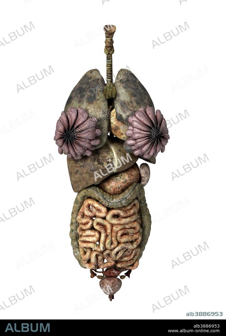 3D rendering of unhealthy female internal organs.