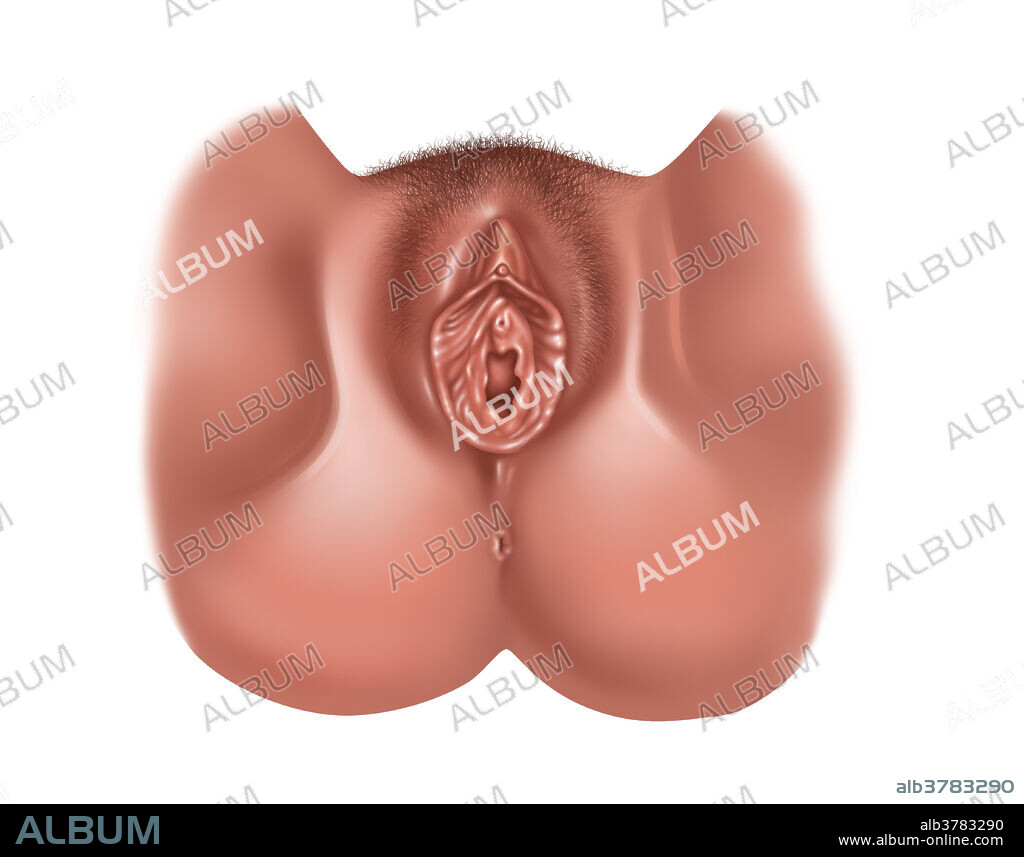 Illustration showing the anatomy of a normal vagina with pubic hair. Depicted are: clitoris, urethra, labia majora, vaginal opening, and the labia minora.
