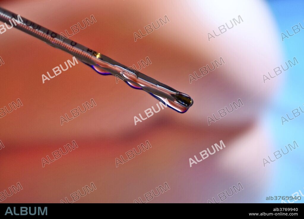 Well lubricated glass, mercury rectal thermometer about to be inserted into the rectum of a waiting patient. Though very accurate, rectal thermometers have largely been replaced by modern digital thermometers due to safety and environmental concerns.