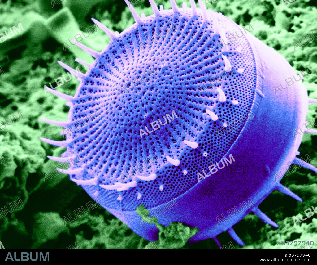 Freshwater Diatom, under a microscope (SEM)