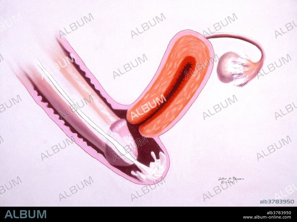 Stimulated by the textures of the female's vagina and the motion during sexual intercourse, the penis ejects about a teaspoon full of semen into the vagina. This is accompanied by the intense pleasure of orgasm. After ejaculation the penis quickly grows too soft to remain in the vagina and is withdrawn.