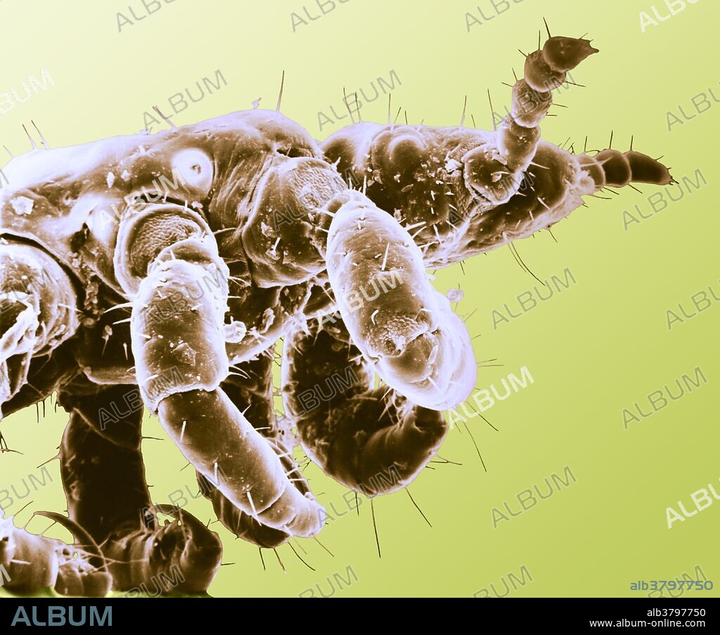 Scanning electron micrograph of a human head louse (Pediculus humanus capitis) on a human hair, magnified 160x at 8" x 10".