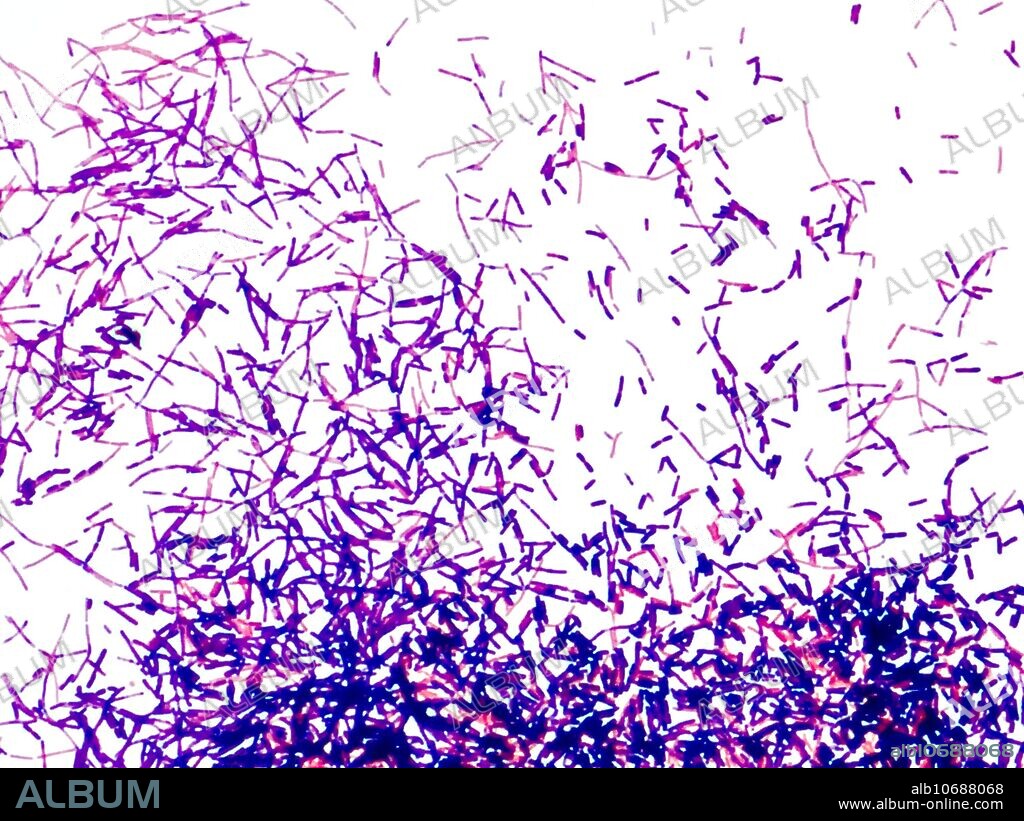 Gram-positive bacteria, light micrograph. These are bacilli (rod-shaped) bacteria. Gram staining divides bacteria into two groups (Gram-positive or Gram-negative) based on the chemical and physiological properties of their cell walls. Gram-positive bacteria retain the crystal violet dye during the Gram stain process and so appear blue or violet under a microscope. Gram-negative bacteria appear red or pink. Magnification: x2800 when printed at 10 centimetres wide.