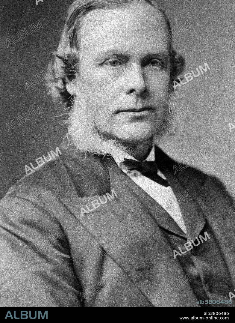 Joseph Lister (April 5,1827 - February 10, 1912) was an English surgeon and a pioneer of antiseptic surgery. Until Lister's studies of surgery most people believed that chemical damage from exposures to bad air (miasma) was responsible for infections in wounds. He found that carbolic acid solution swabbed on wounds remarkably reduced the incidence of gangrene. Lister tested the results of spraying instruments, the surgical incisions, and dressings with a solution of it. He instructed surgeons under his responsibility to wear clean gloves and wash their hands before and after operations with 5% carbolic acid solutions. Instruments were also washed in the same solution and assistants sprayed the solution in the operating theater. As the germ theory of disease became more widely accepted, it was realized that infection could be better avoided by preventing bacteria from getting into wounds in the first place. Lister died in 1912 at the age of 84.